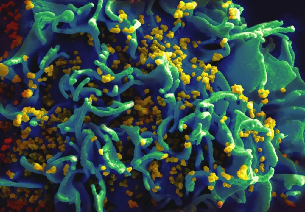 New 'vaccine-like' HIV drug could cost just $40: researchers