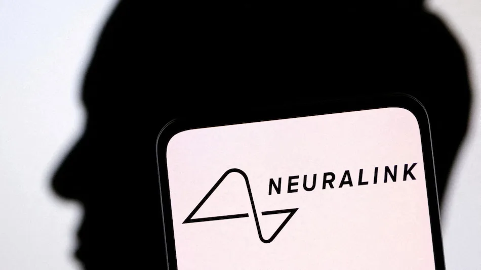 Elon Musk's Neuralink Says Second Brain Device Implant ‘Went Well’