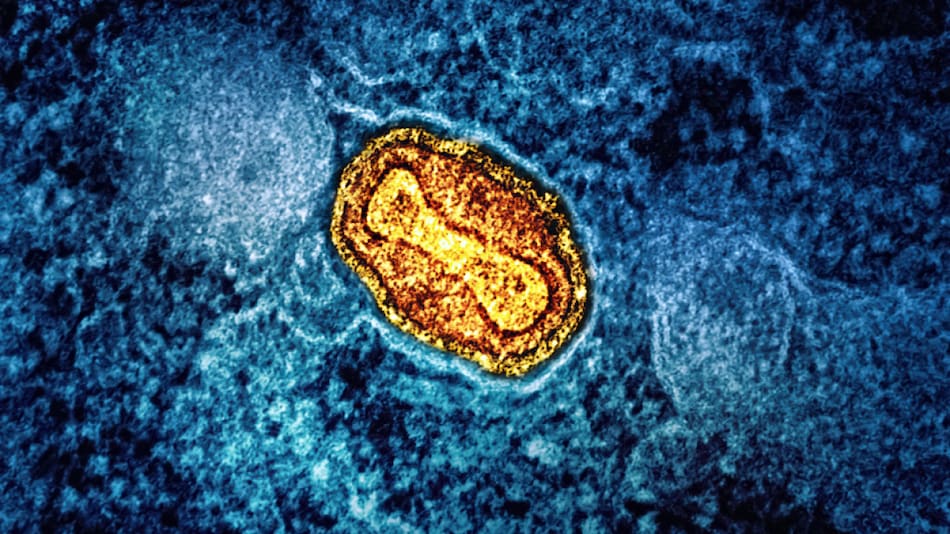 Mpox Virus Outbreak: Understanding the Complex Transmission and Global Spread